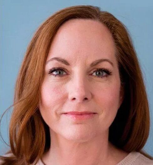 Après avoir utilisé la crème Eudalie, le visage de Joanna a été transformé
