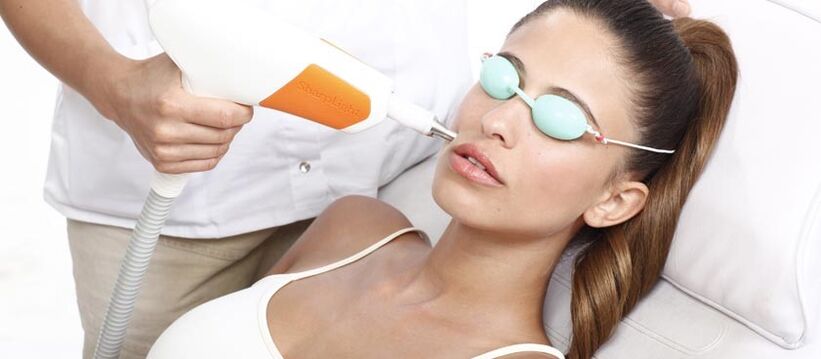 Resurfaçage de la peau au laser